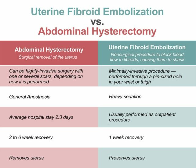 Uterine Fibroid Embolization (UFE) | Fairfax Vascular Center